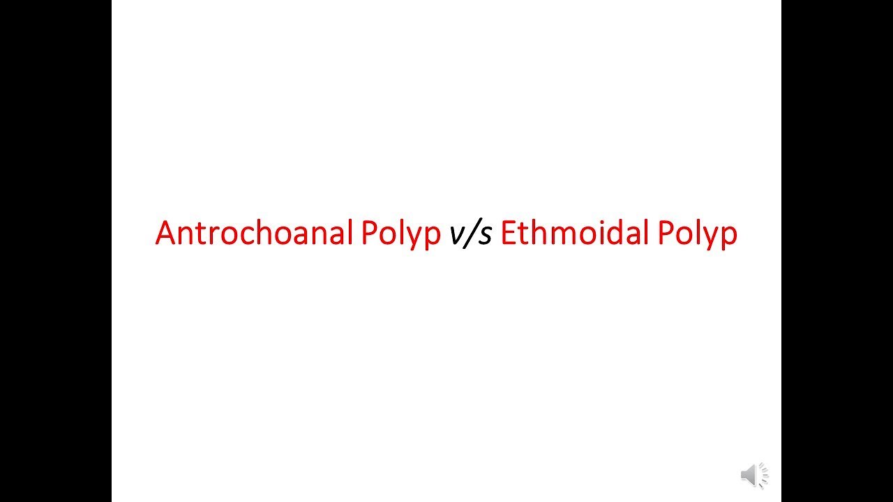 Antrochoanal Polyp v/s Ethmoidal Polyp