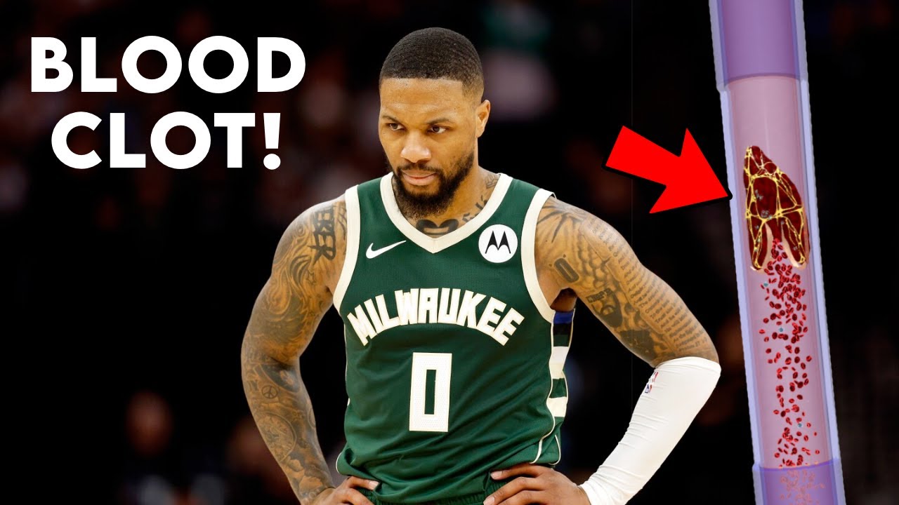 Damian Lillard Out with Blood Clot (DVT) - Doctor Explains