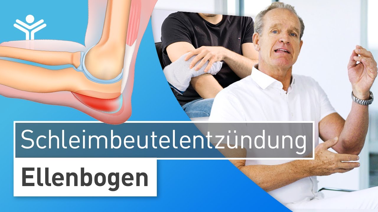 Schleimbeutelentz&uuml;ndung am Ellenbogen (Bursitis) &ndash; Schwellung selbst behandeln oder sofort zum Arzt?