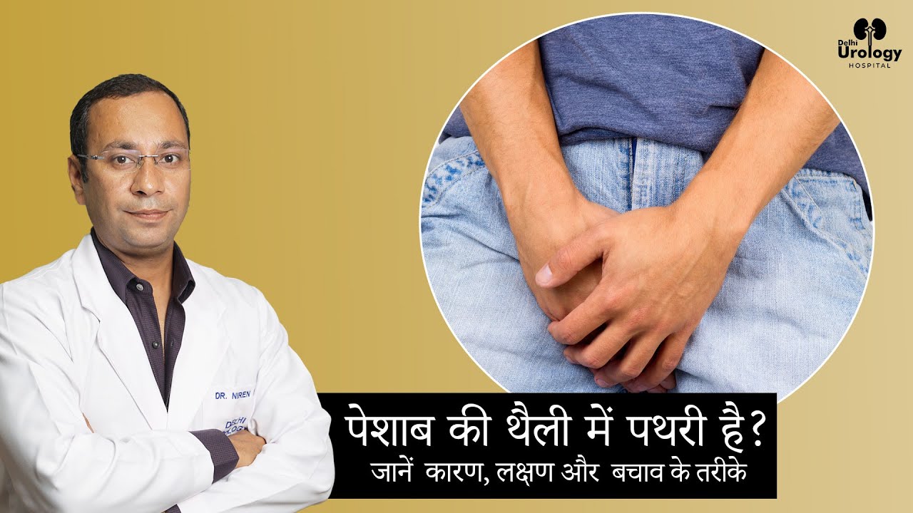 Bladder Stone Causes & Symptoms | (पेशाब की थैली में पथरी?) | Bladder Stone Specialist in Delhi