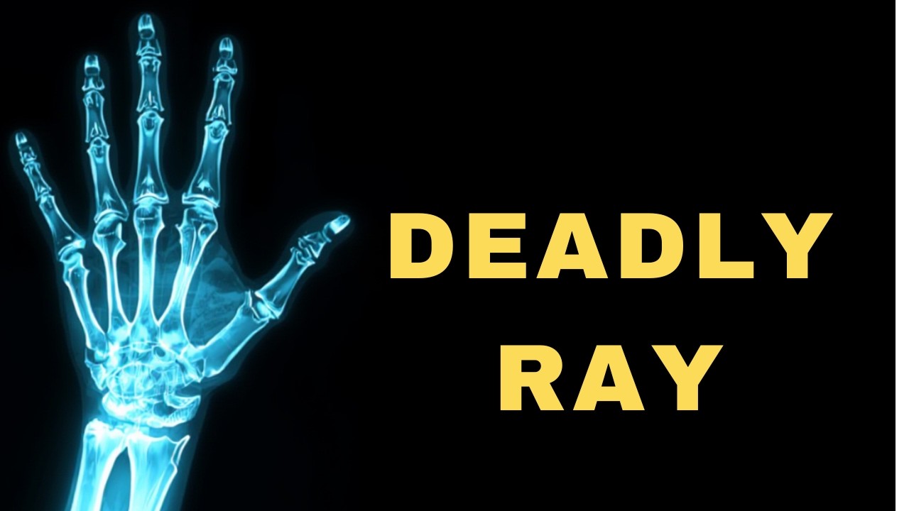Beautiful Mistake: The Accident That Created X-Rays, Why Scientists Started Dying