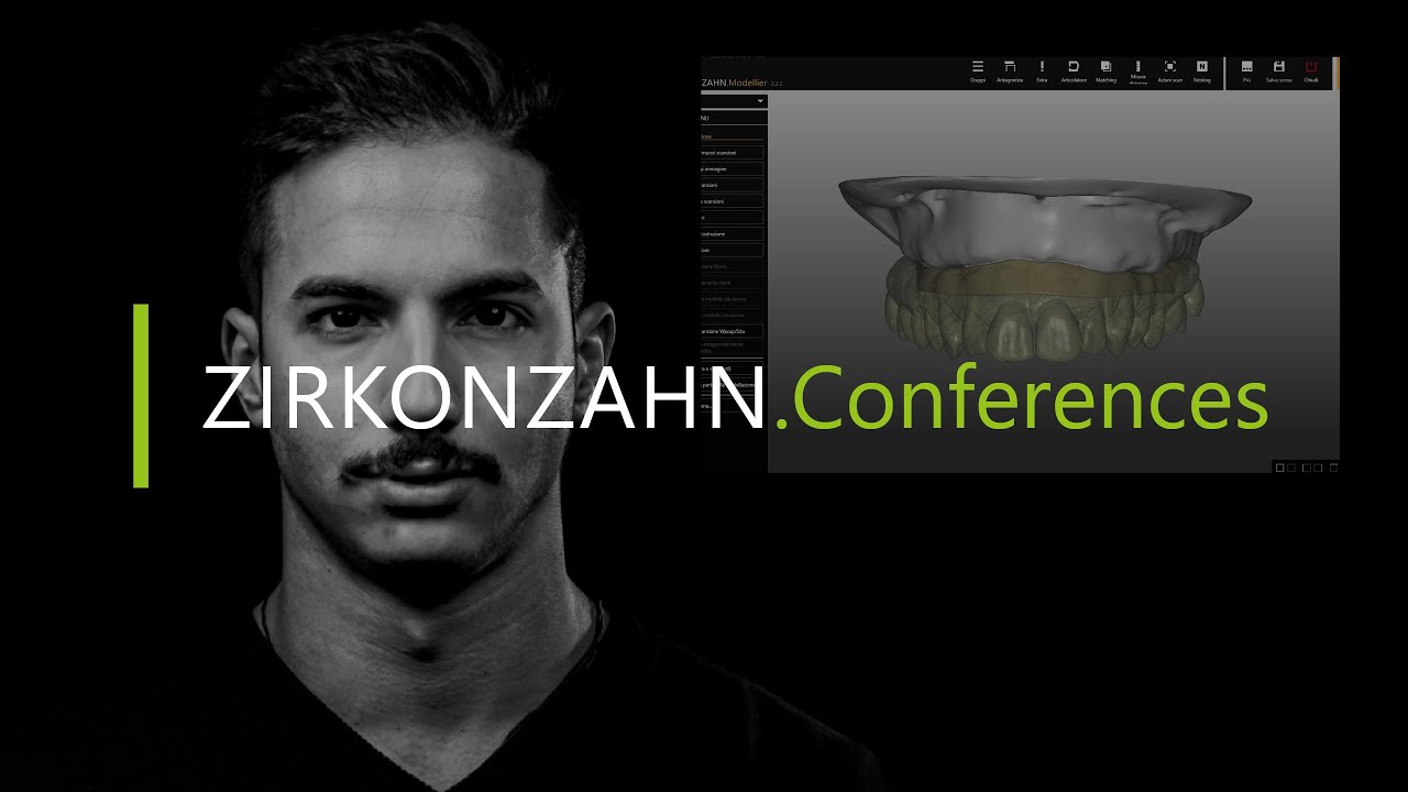 Flusso di lavoro digitale Zirkonzahn – Ponte Prettau® su barra | Zirkonzahn.Conferences
