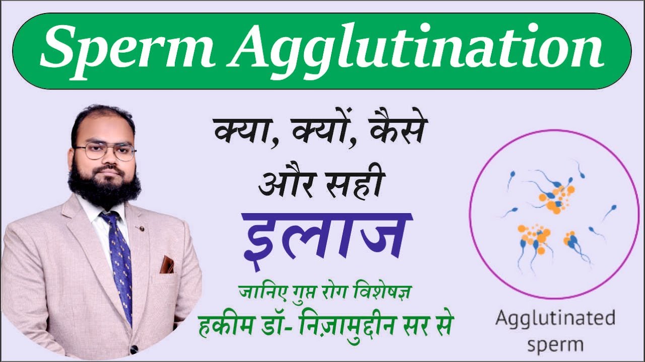 Dr. Nizamuddin Qasmi: Sperm Agglutination Explained by Infertility Expert