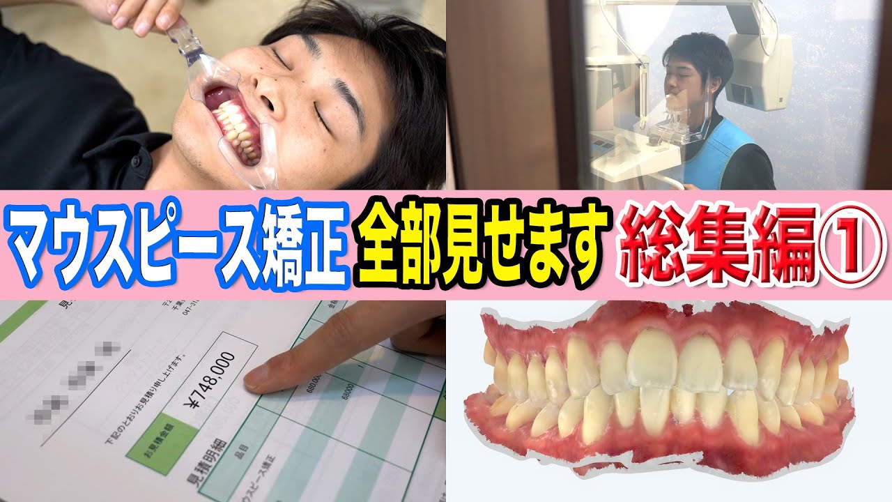【歯列矯正】これを見れば全てがわかる！スタッフのマウスピース矯正企画総集編①