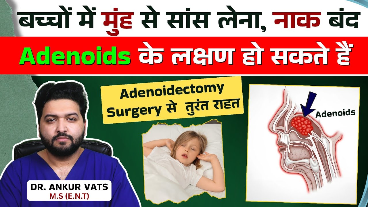 Why Kids Sleep with Mouth Open | Adenoids Causes & Treatment
