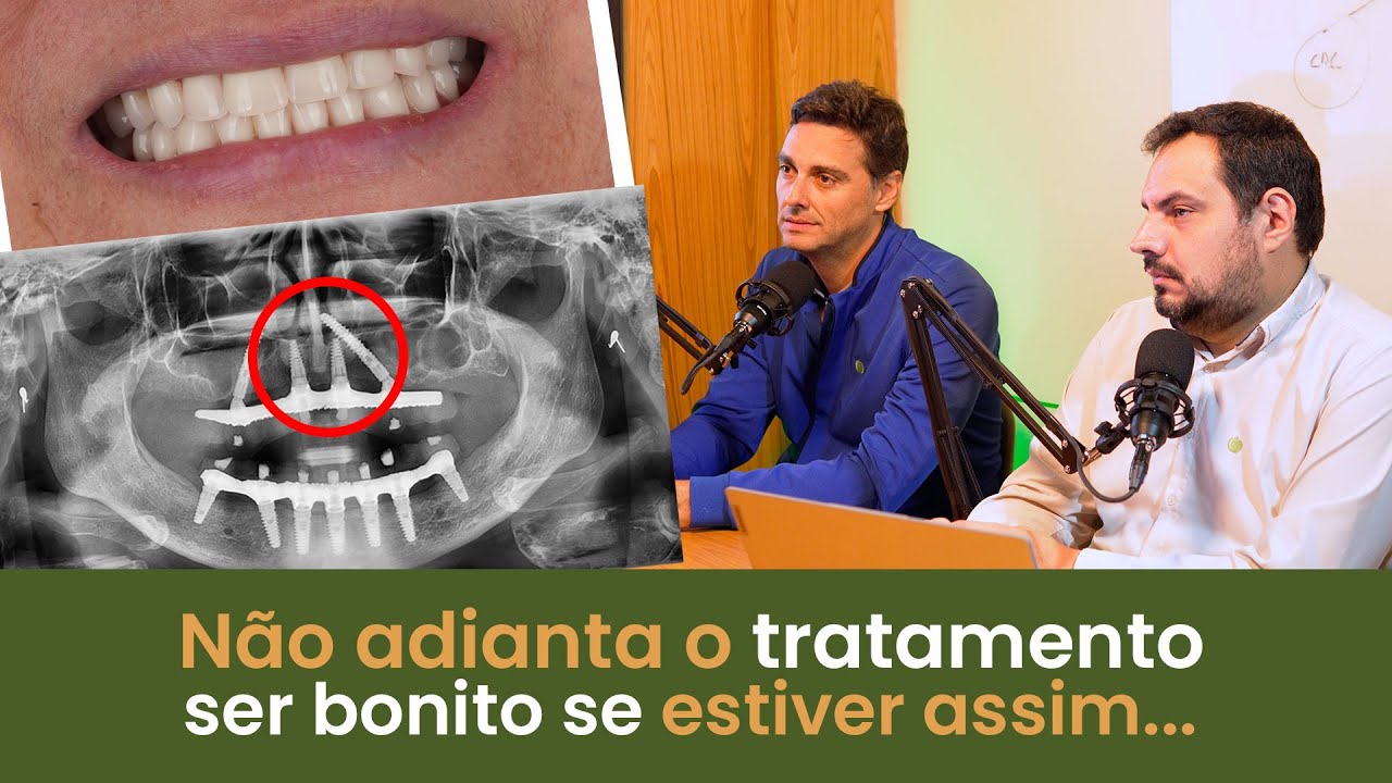 N&atilde;o Adianta Ficar Bonito... Se o Tratamento Estiver Assim!&rdquo; &ndash; Implace Implantes