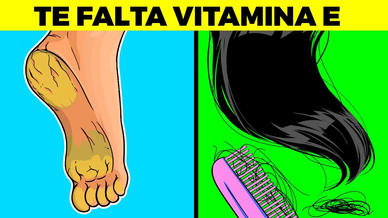 SEÑALES DE QUE TE FALTA VITAMINA E Y NO SABÍAS