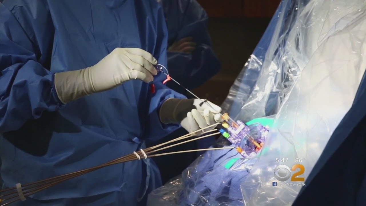Dr. Max Gomez: OCD Brain Surgery