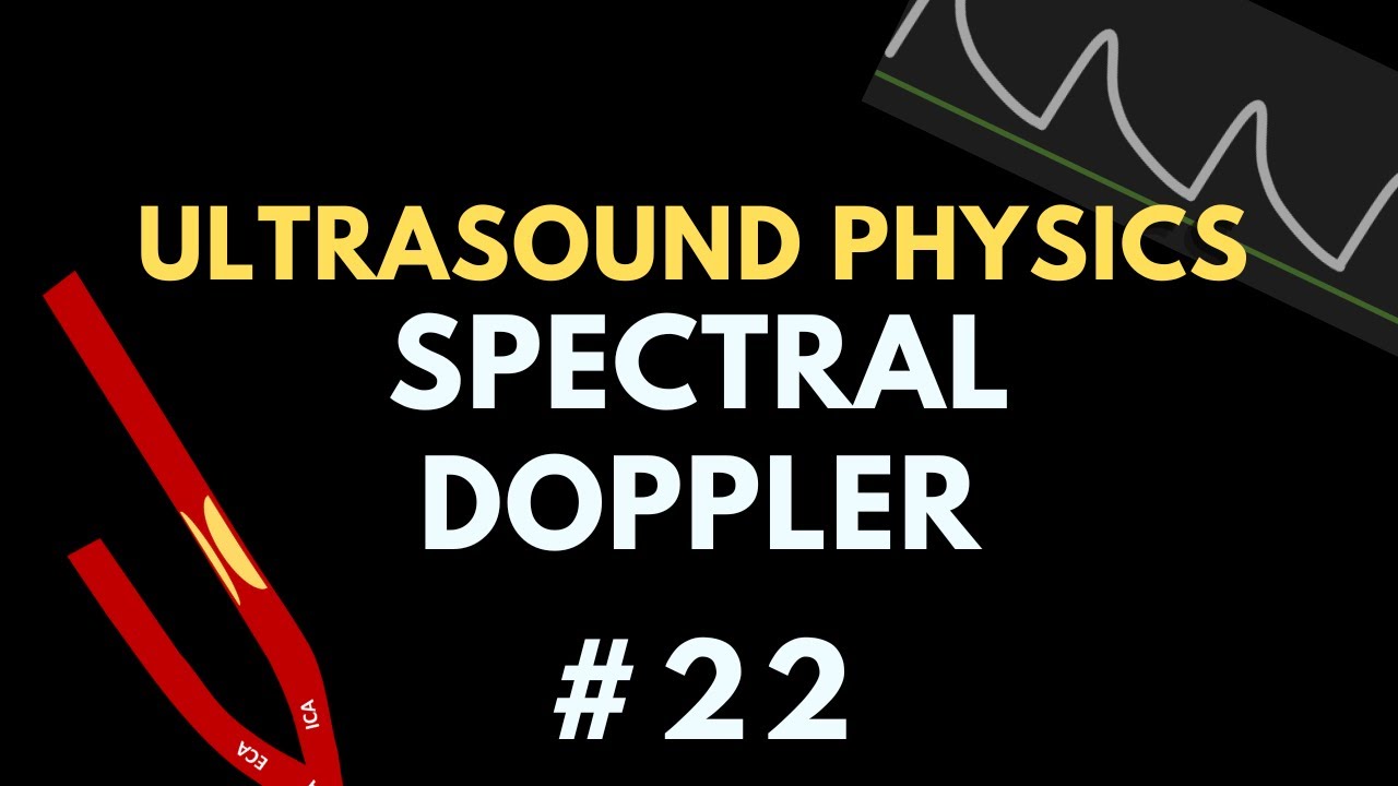 Spectral Doppler Ultrasound | Ultrasound Physics Course | Radiology Physics Course #22