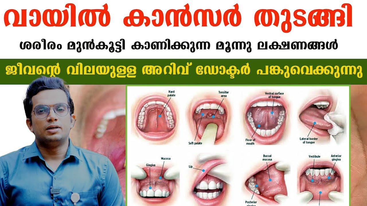 വായിൽ കാൻസർ തുടങ്ങി ശരീരം കാണിച്ചുതരുന്ന മൂന്നു ലക്ഷണങ്ങൾ ജീവന്റെ വിലയുള്ള അറിവ് /Dr Arun / VAAYIL