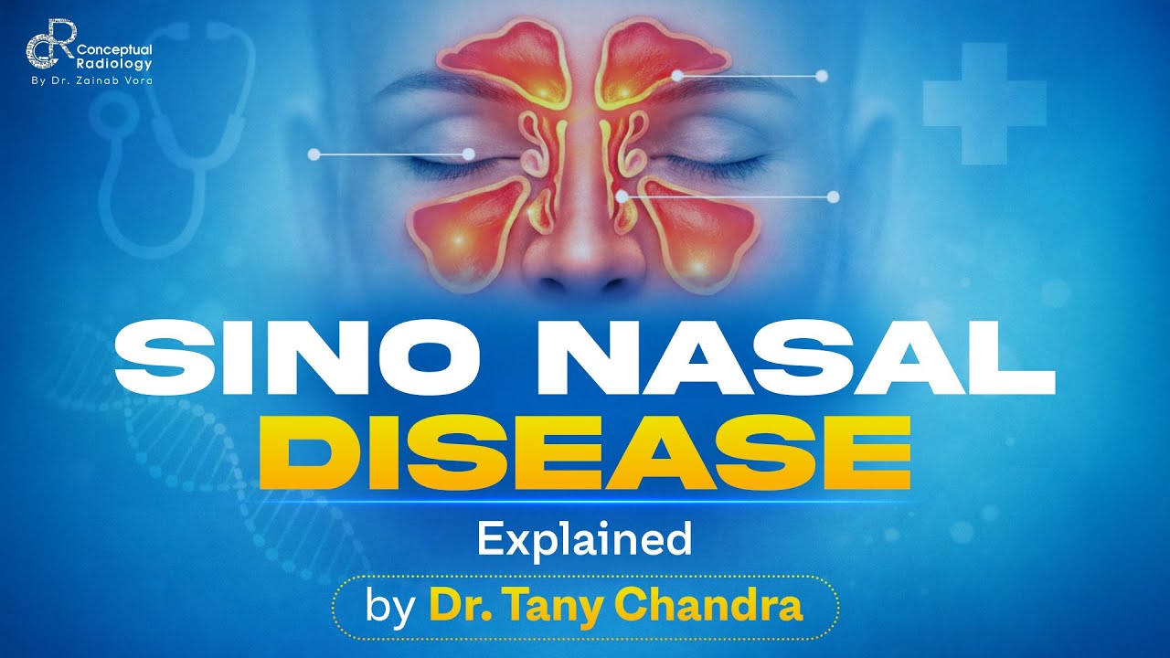 Sino-Nasal Disease Explained | Dr. Tany Chandra