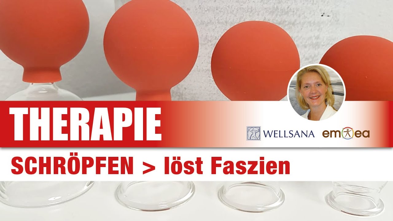 Schr&ouml;pfen - l&ouml;st Faszien