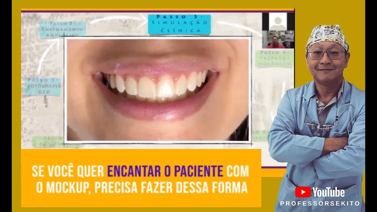 Se voc&ecirc; quer encantar o paciente com o mockup, precisa fazer dessa forma