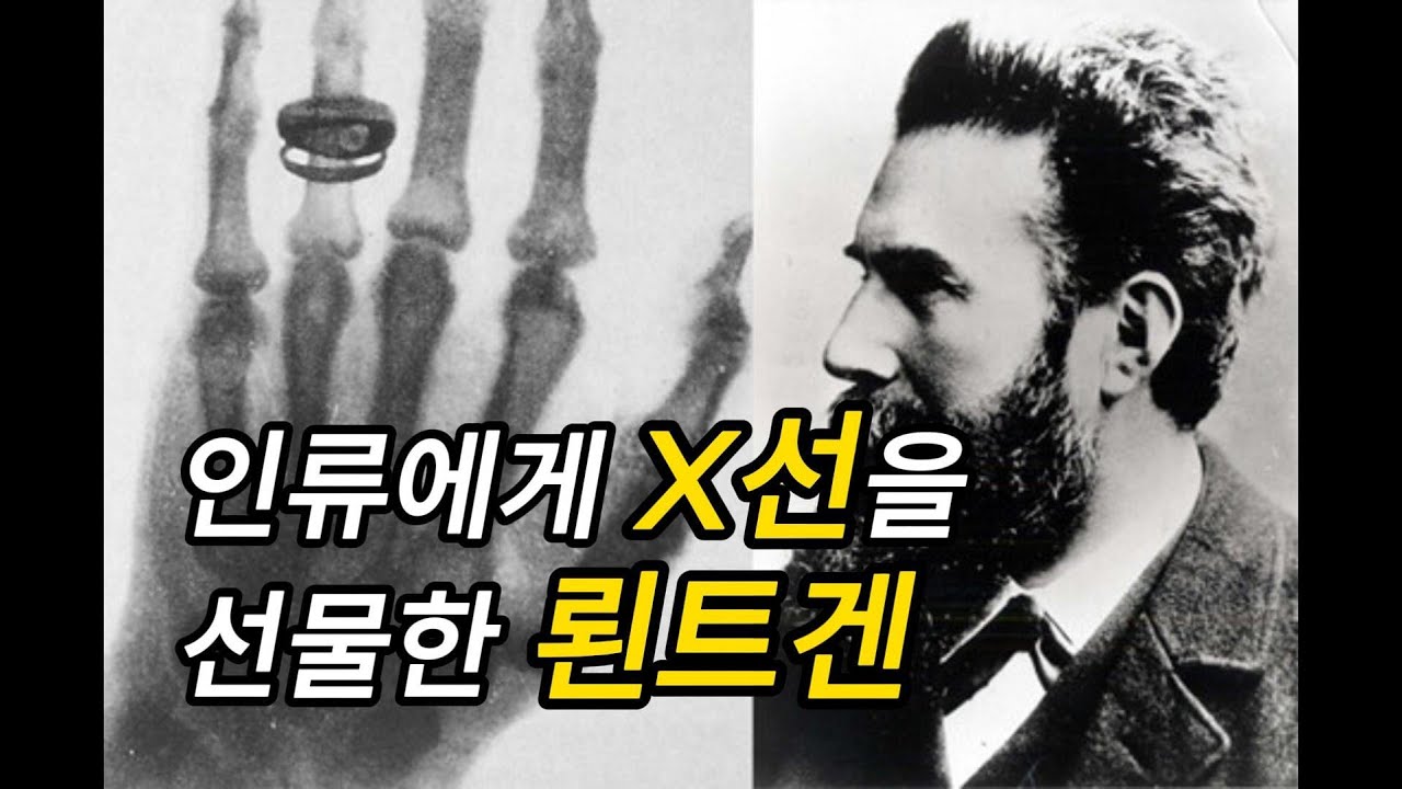 인류에게 X선을 선물한 뢴트겐