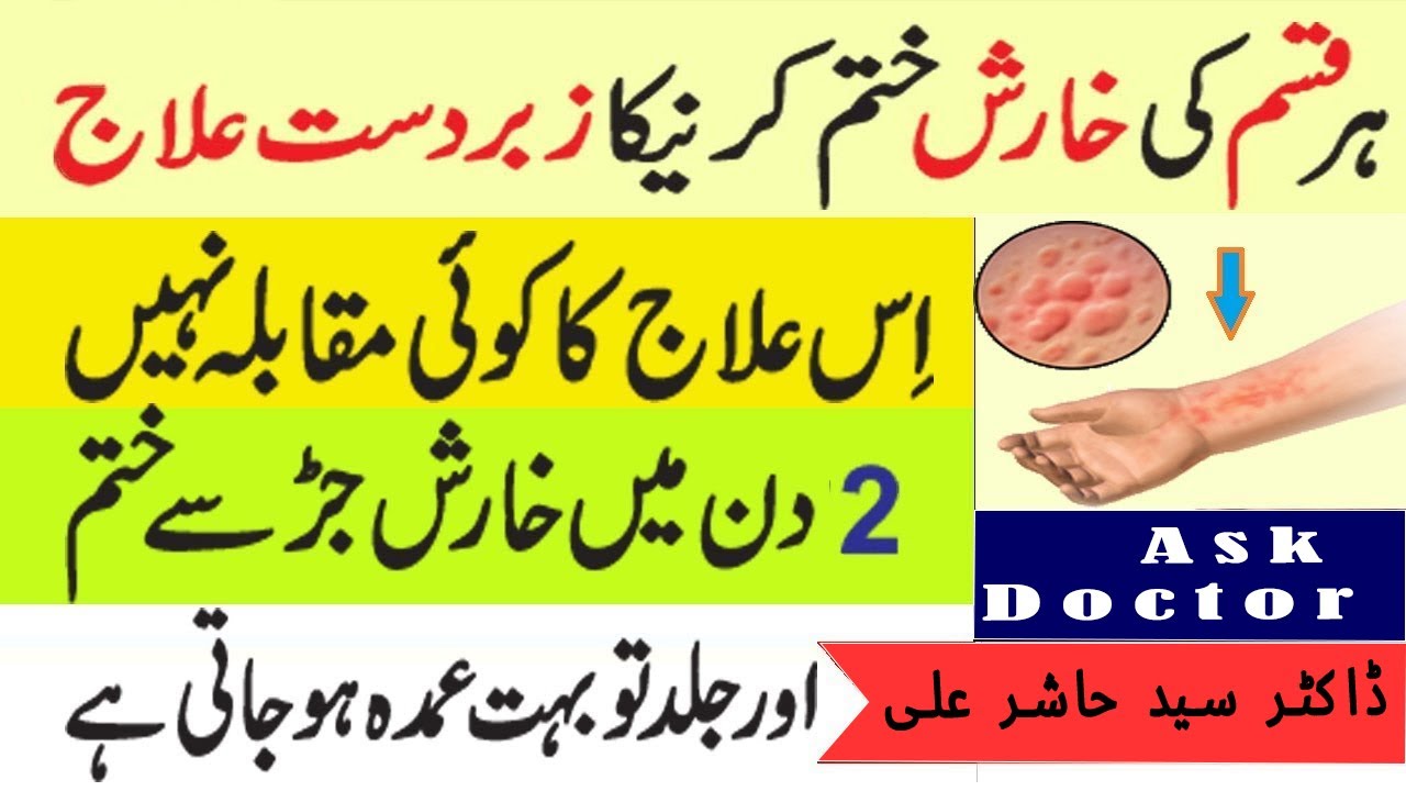 Itching /Kharish ka Fori ilaj.😳dawae 😌 Anti itching cream | anti histamine in medicinal chemistry.