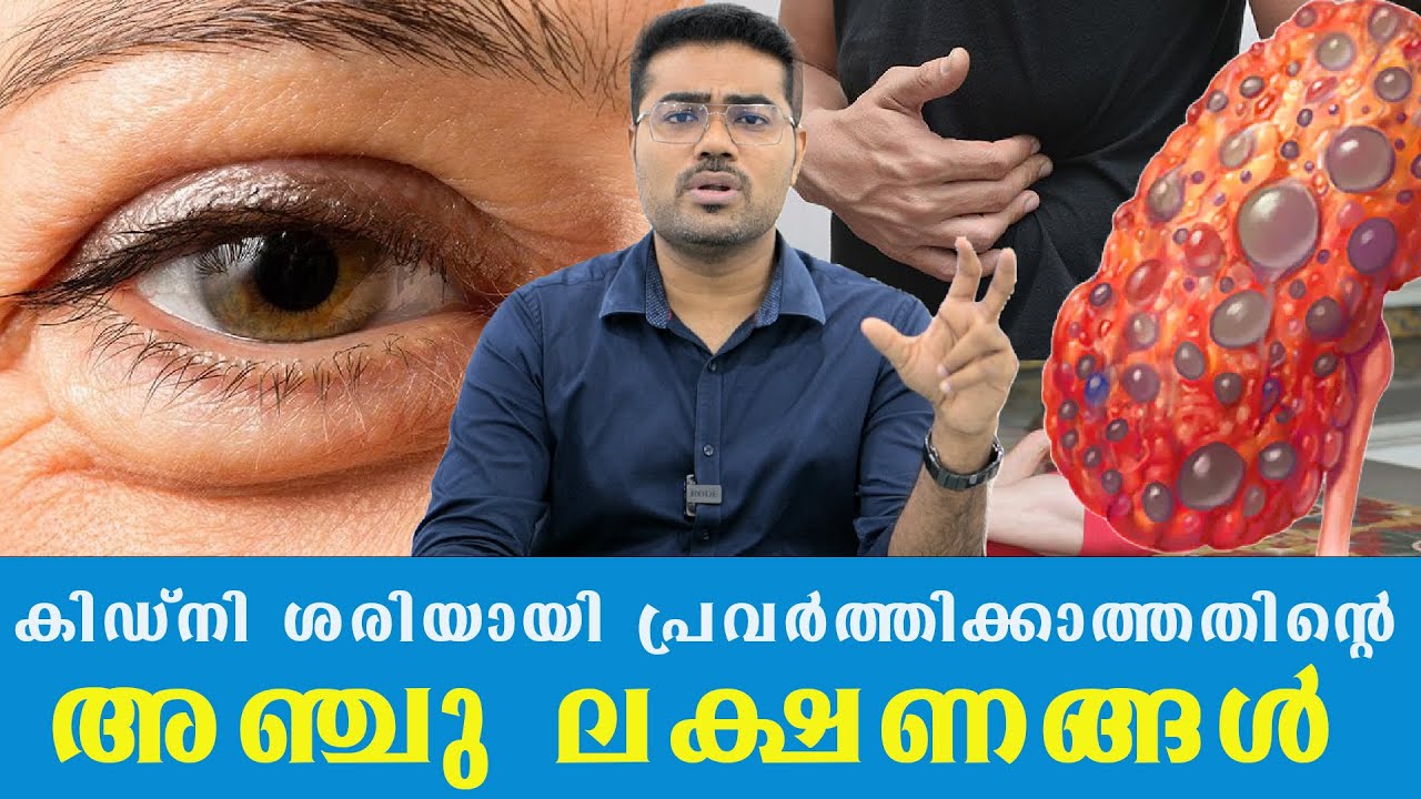 കിഡ്നി ശരിയായി പ്രവർത്തിക്കാത്തതിന്റെ അഞ്ചു ലക്ഷണങ്ങൾ /Dr Manoj Johnson