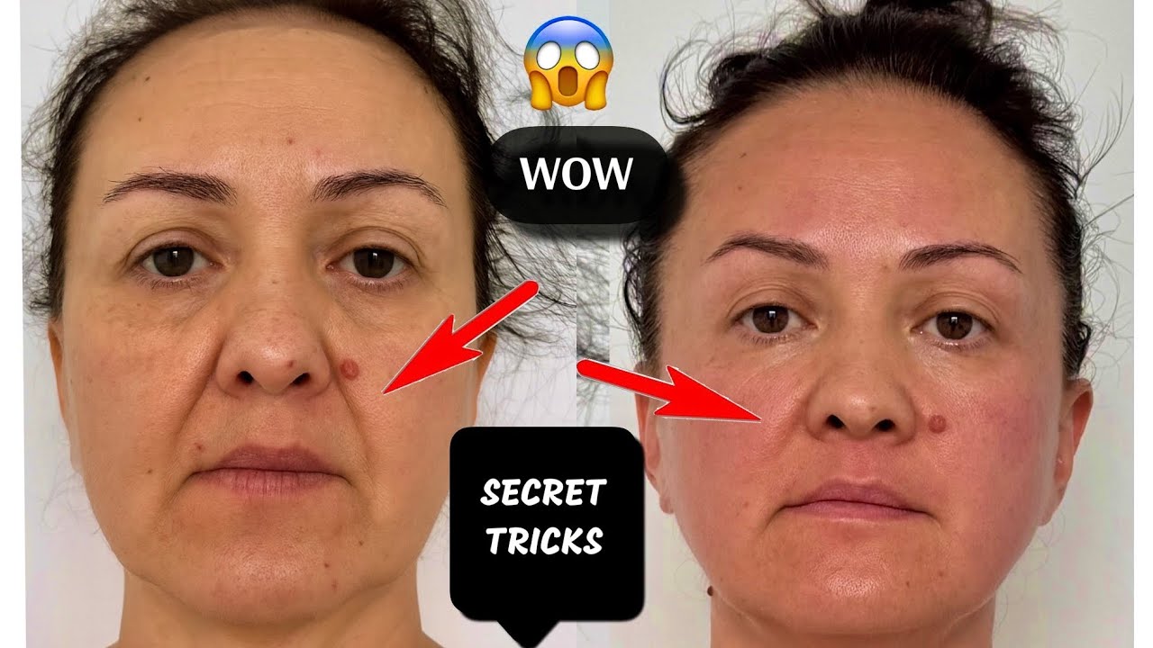 SECRET Massage for Heavy NASOLABIAL FOLDS | THE BEST FROM MASSAGE 🔥| Do it with me