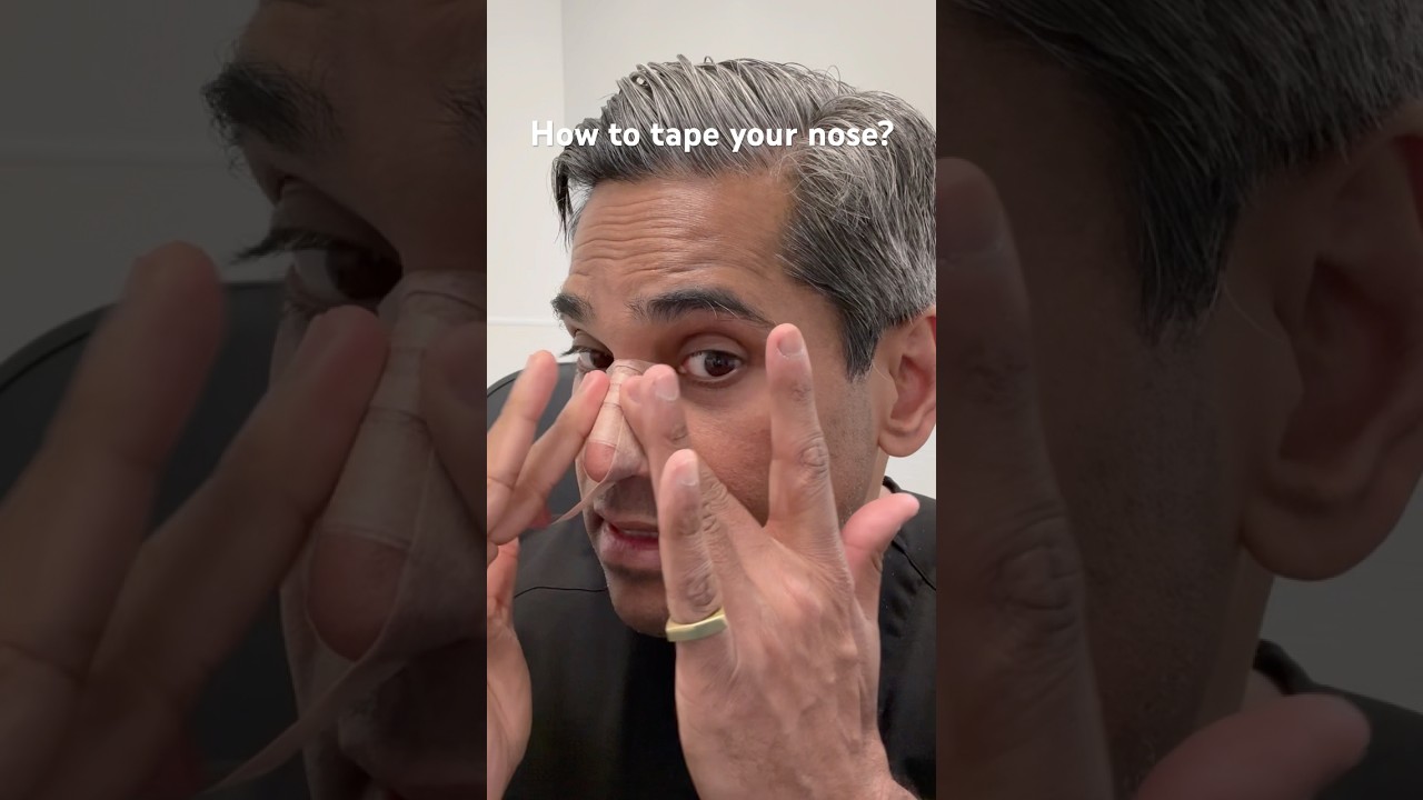 Rhinoplasty Taping to Manage Swelling