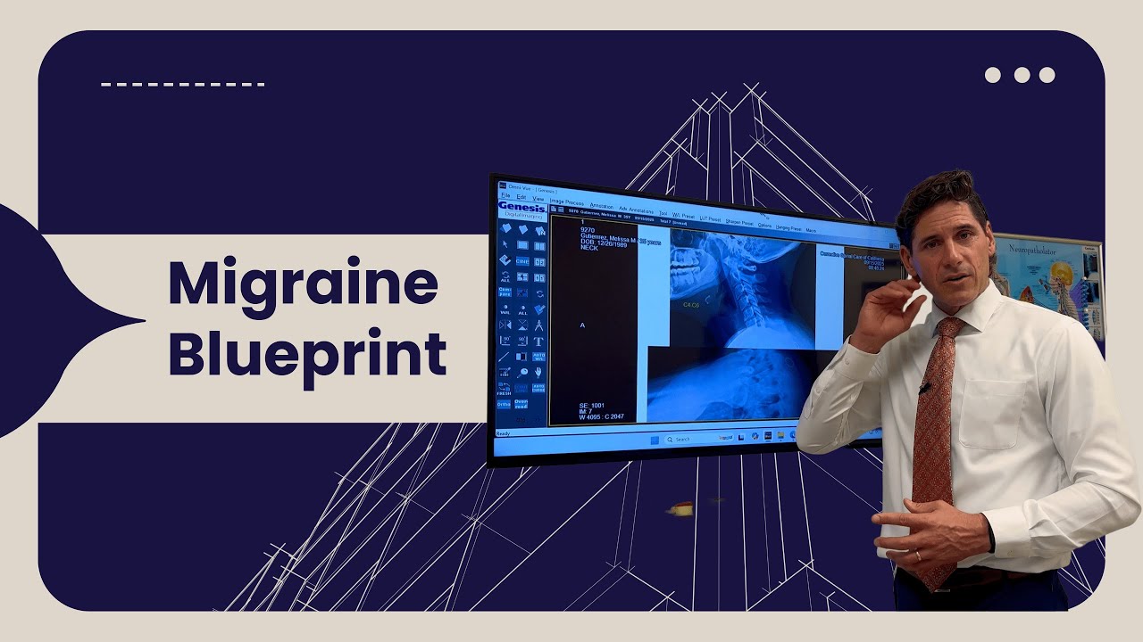 Migraine Relief Starts With Imaging | Chiropractor in Escondido, CA