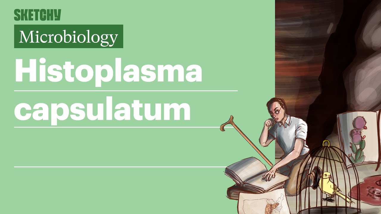 Histoplasma capsulatum | USMLE, шаг 1 | Sketchy Medical