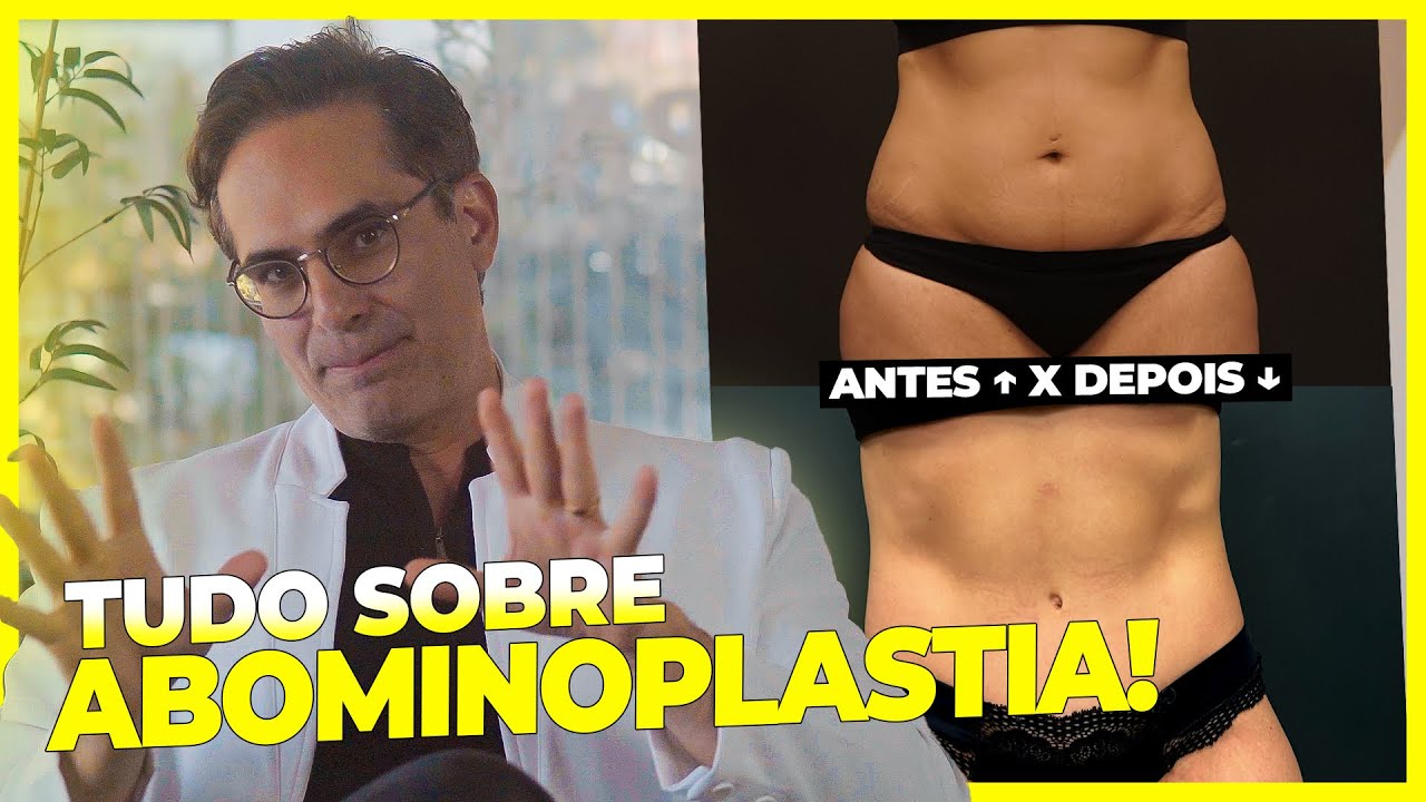 Cirurgião Plástico Revela SEGREDOS sobre ABDOMINOPLASTIA!