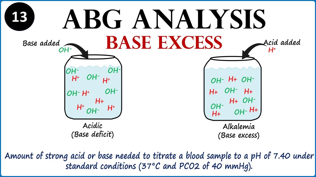 ABG interpretation | Base excess, deficit | part 13