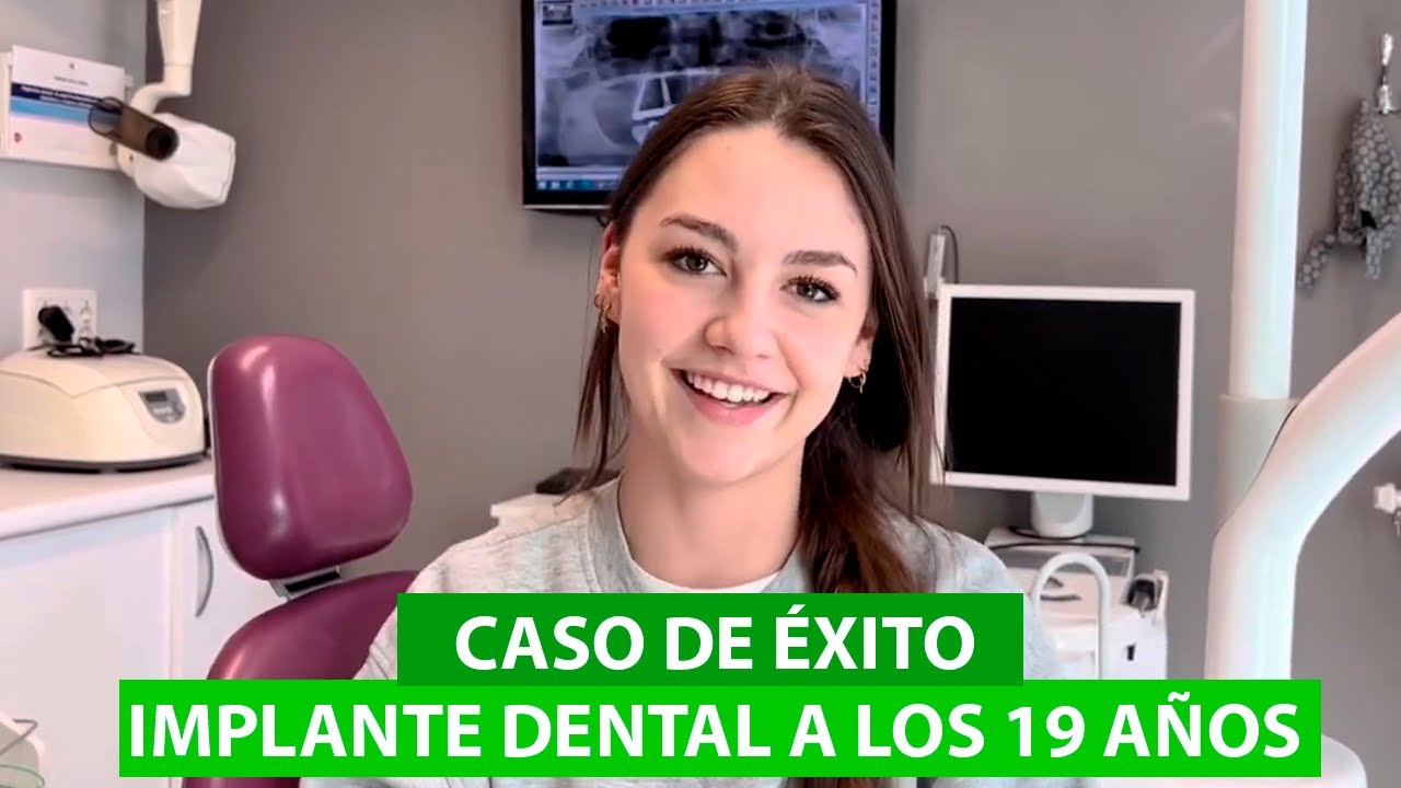 Experiencia: Implante Dental a los 19 años