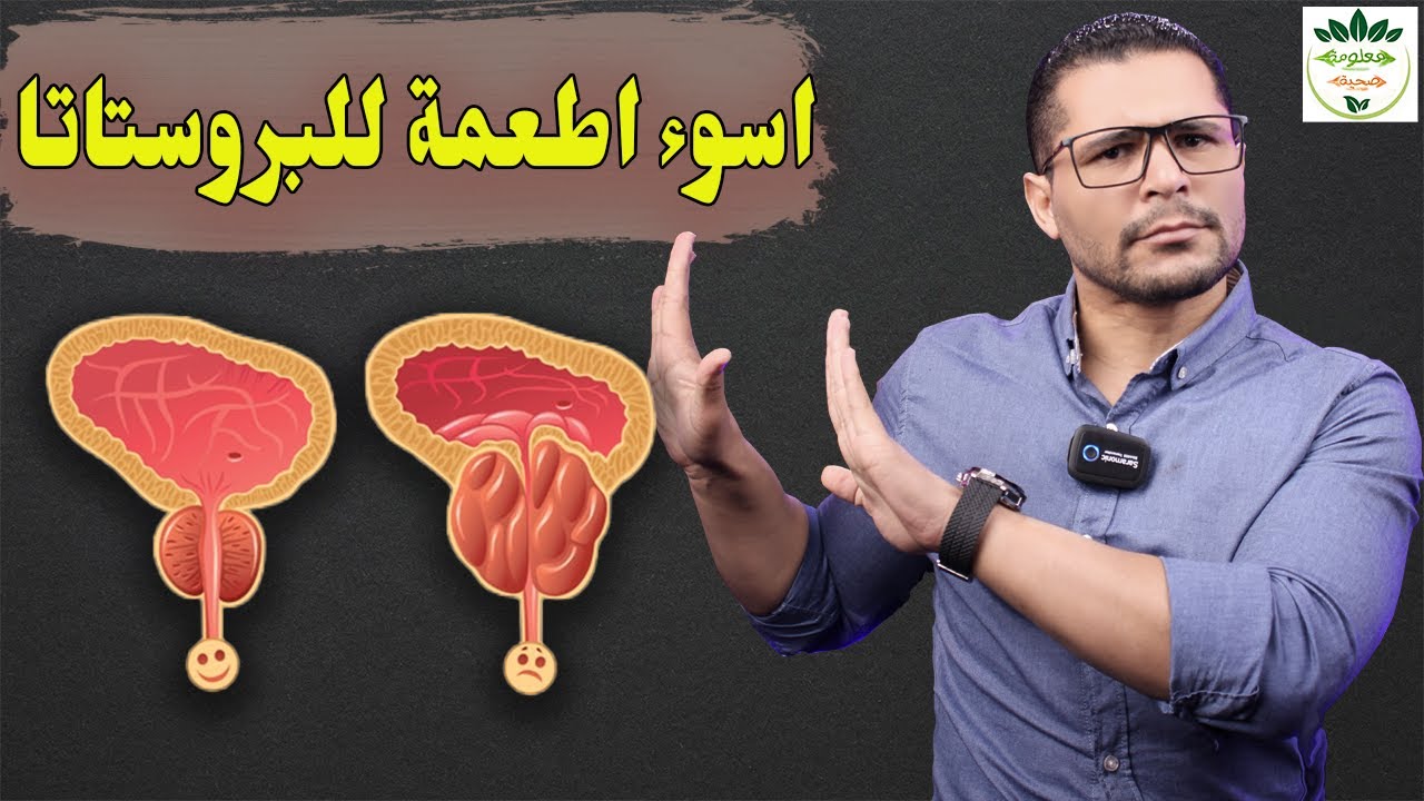 اسوء عشر اطعمه تزيد من تضخم والتهاب البروستاتا