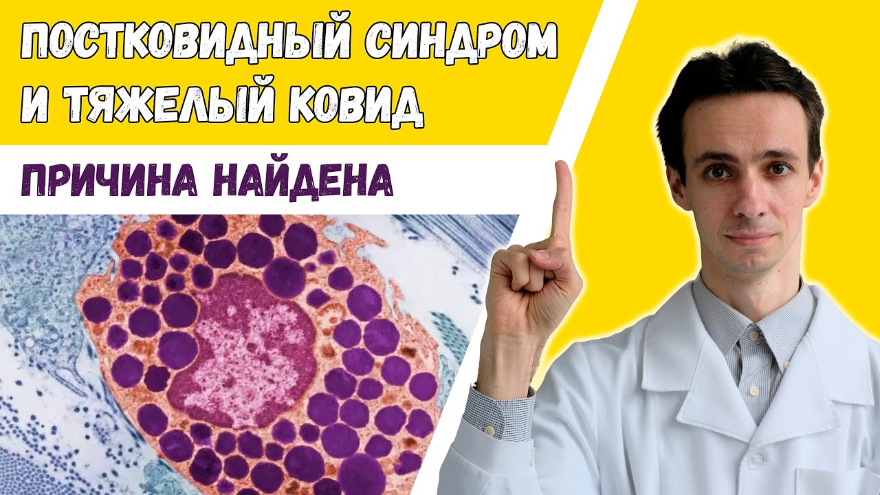 Найдена наиболее вероятная причина ПОСТКОВИДНОГО СИНДРОМА! Виноваты тучные клетки?(видео 1) КОНКУРС!