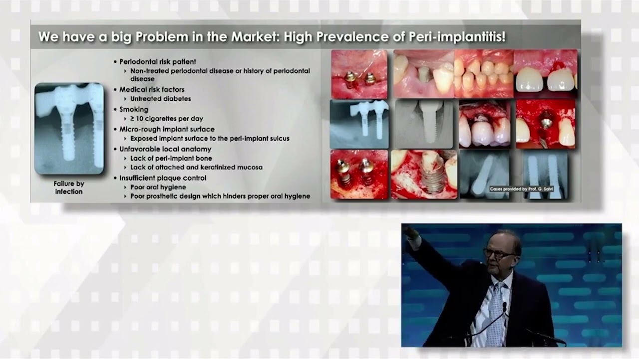 Dr. Daniel Buser explains why implants with hybrid design surfaces reduce peri-implantitis incidence
