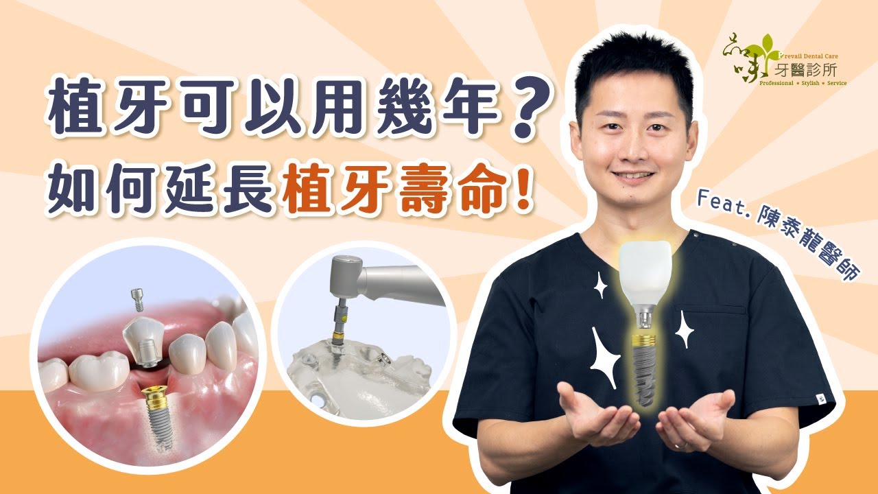 植牙可以用幾年？如何延長植牙壽命呢？Feat.陳泰龍醫師