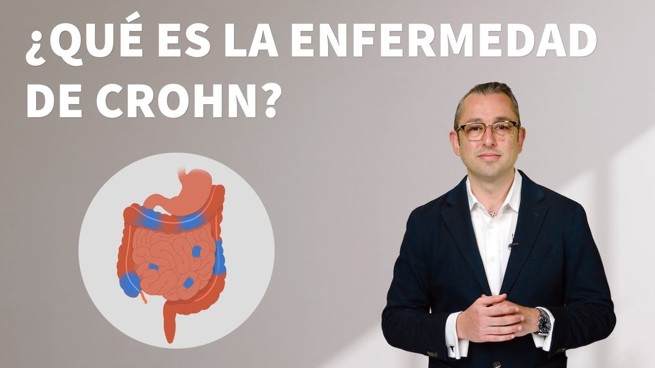 Enfermedad de Crohn: Causas, síntomas y tratamientos | Stanford