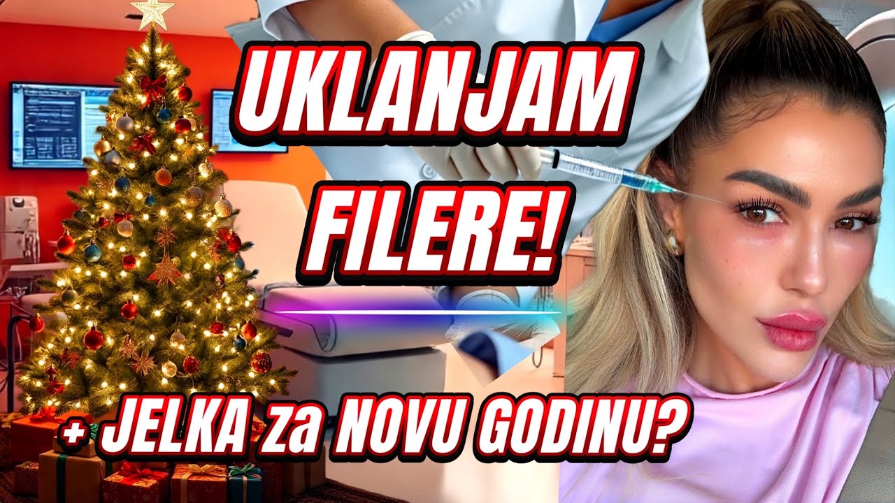 uklanjam FILERE, event sa Daneen i JELKA 🎄