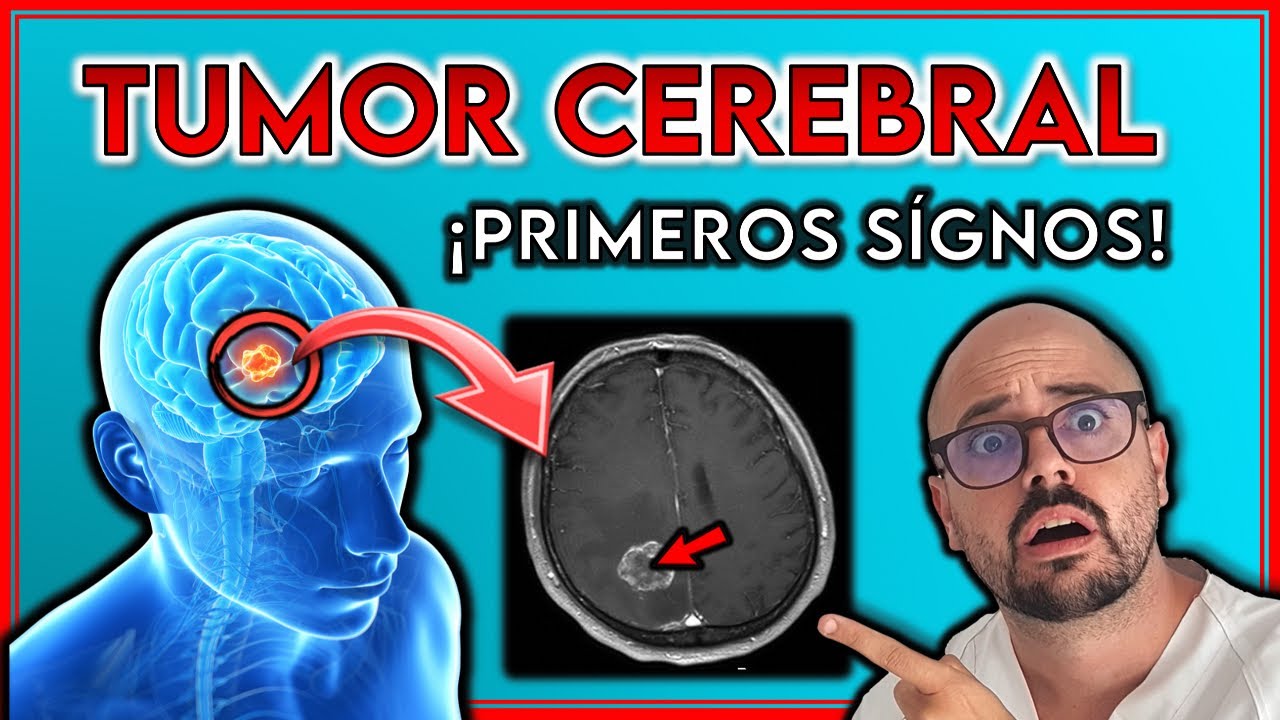 ¡ESTOS son TODOS los SÍNTOMAS de un TUMOR CEREBRAL! || ¡SIGNOS de ALERTA!