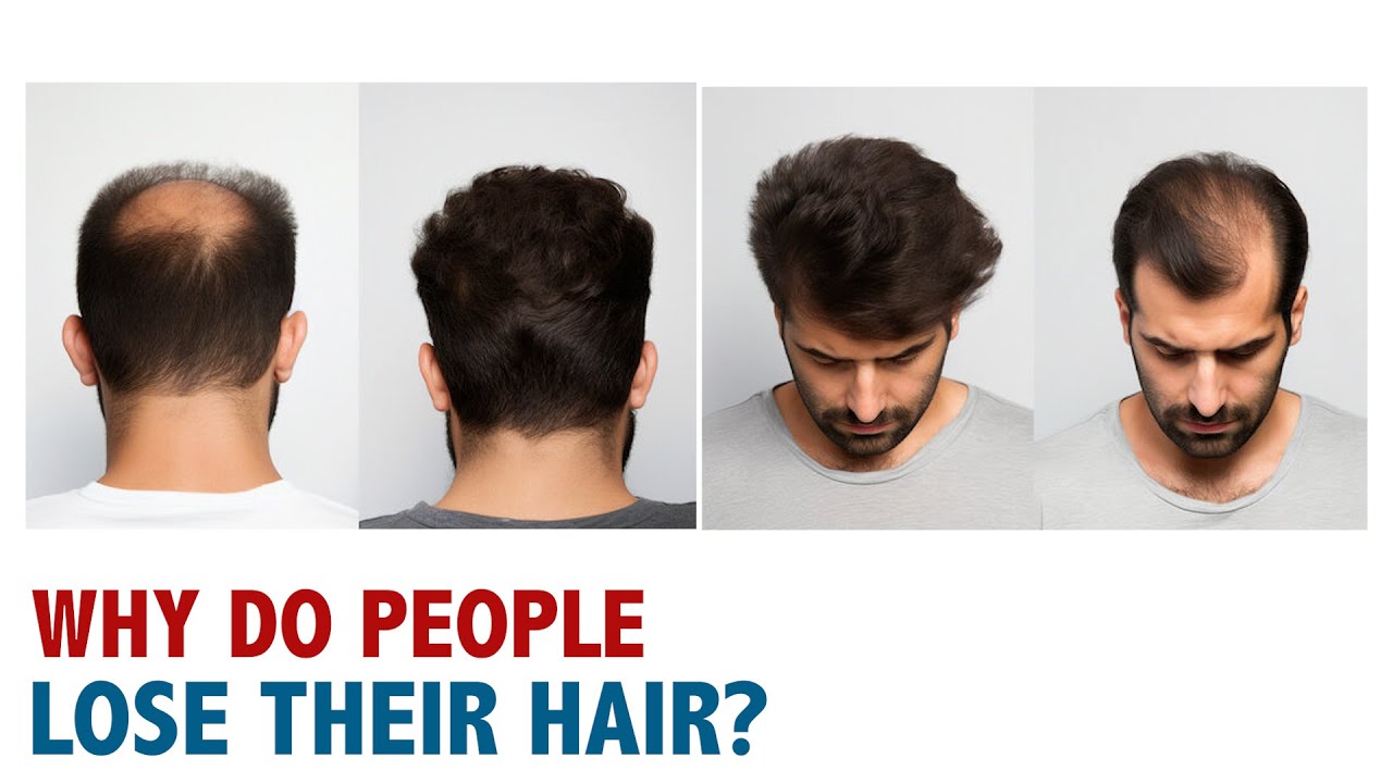 Why Do People Lose Their Hair?