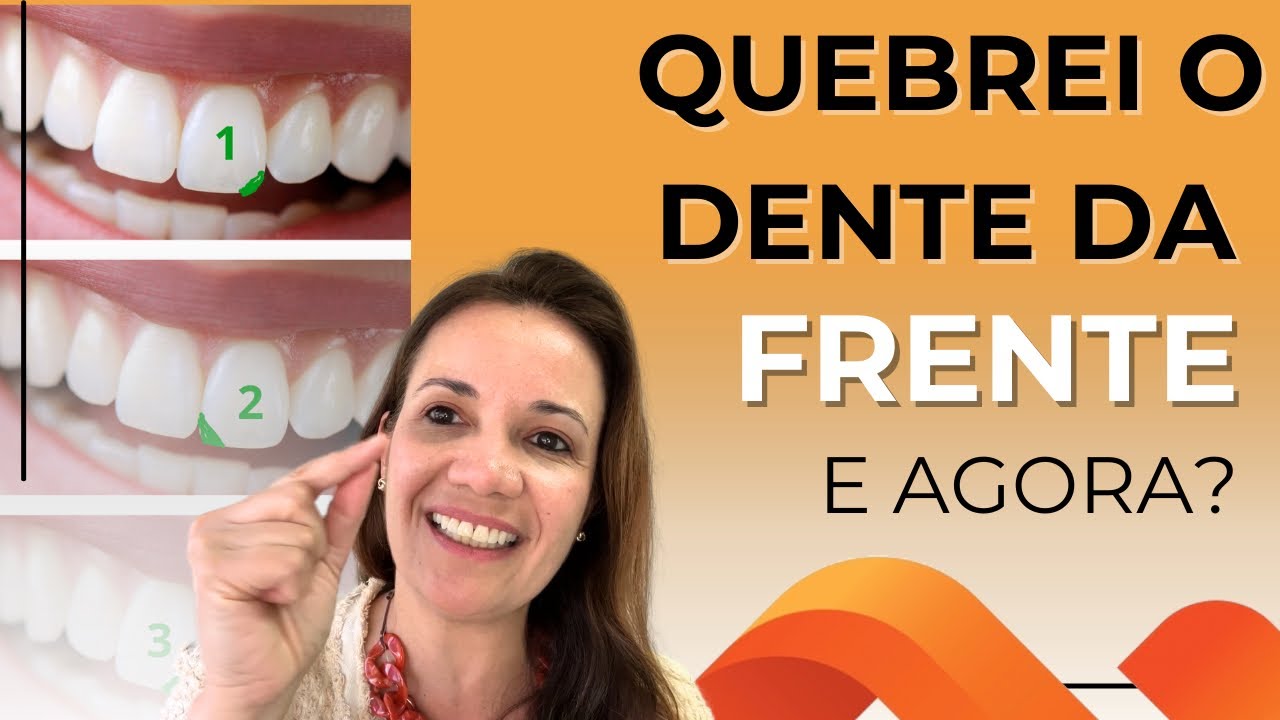 DENTE DA FRENTE QUEBRADO: O QUE FAZER? - DRA. MELISSA LUCENA