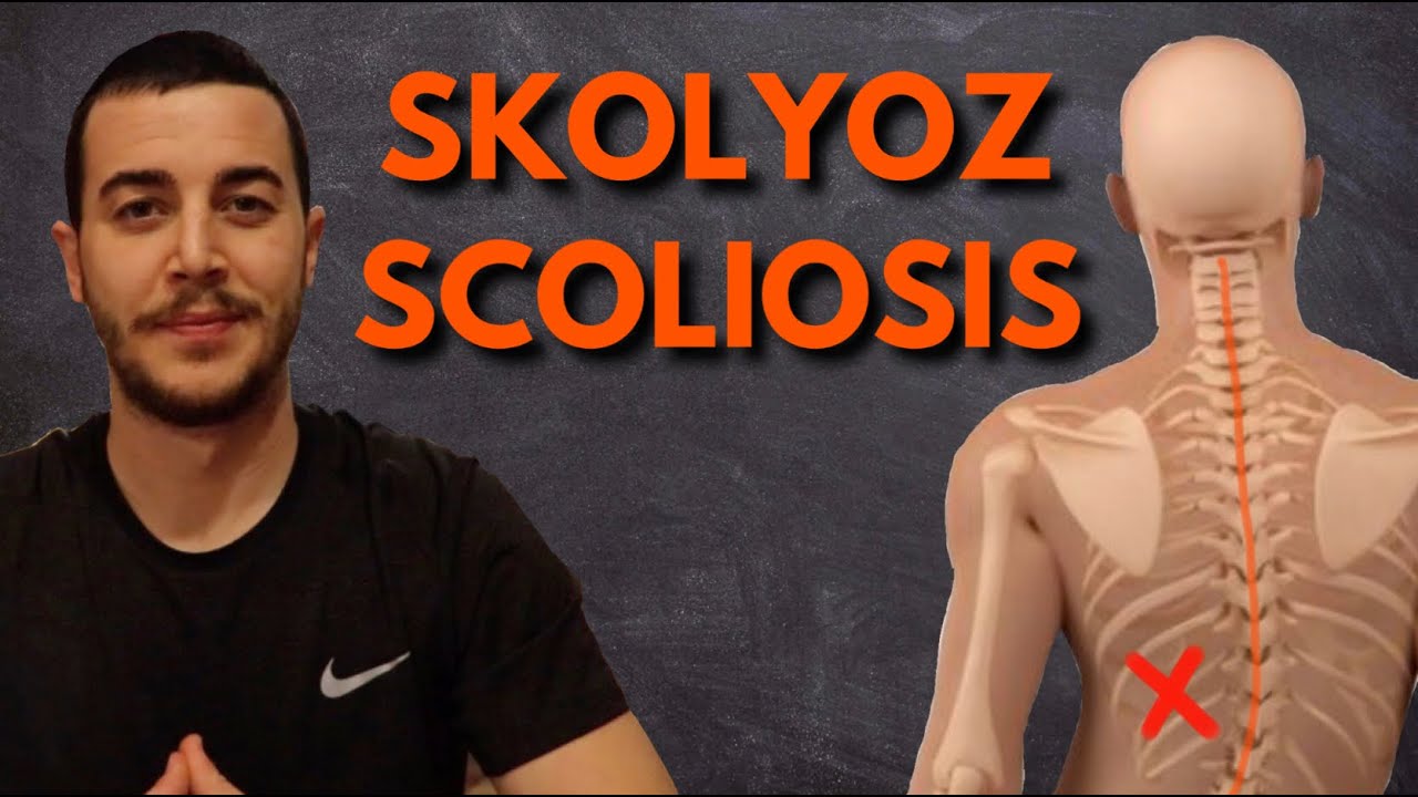 Skolyoz İçin Egzersizler | Exercises For Scoliosis