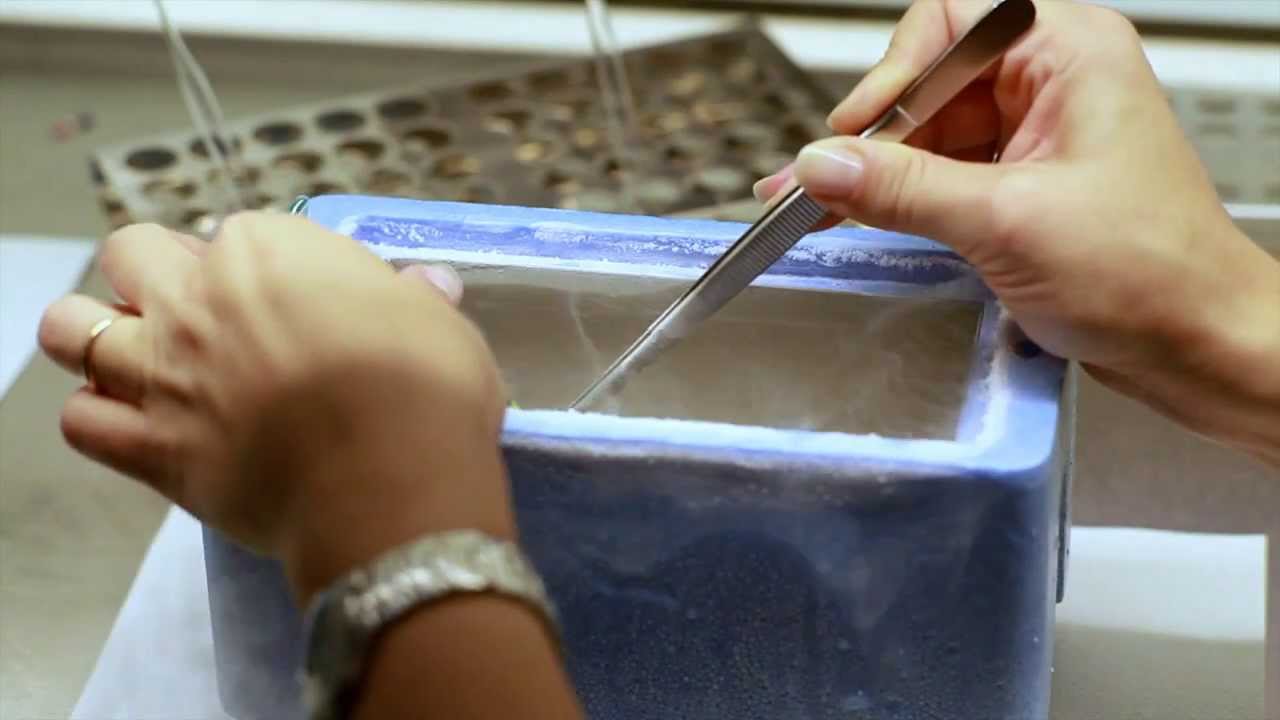 Medizinisch unterstützte fortpflanzung IVI - GENDIAGNOSTIK PID (EU, 2014)