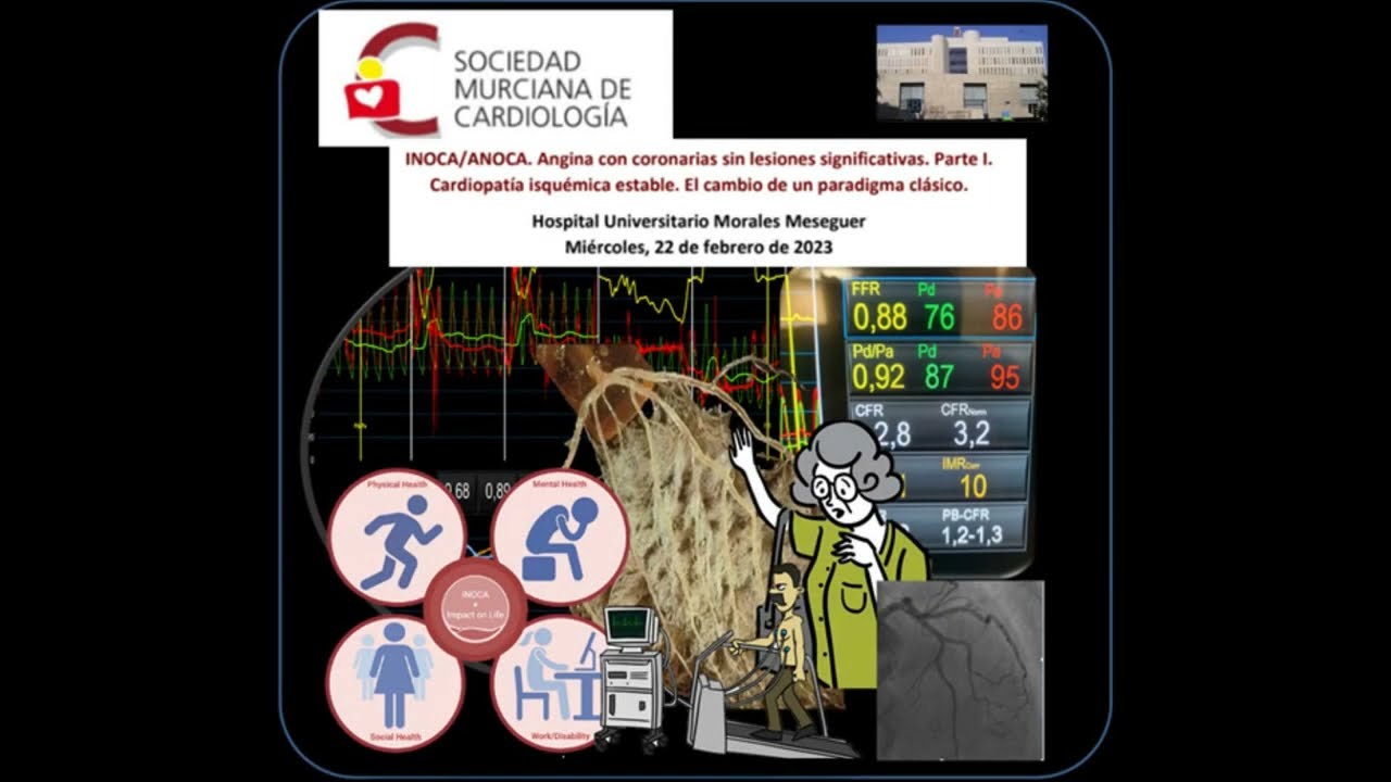 Curso INOCA/ANOCA. Angina con coronarias sin lesiones significativas.