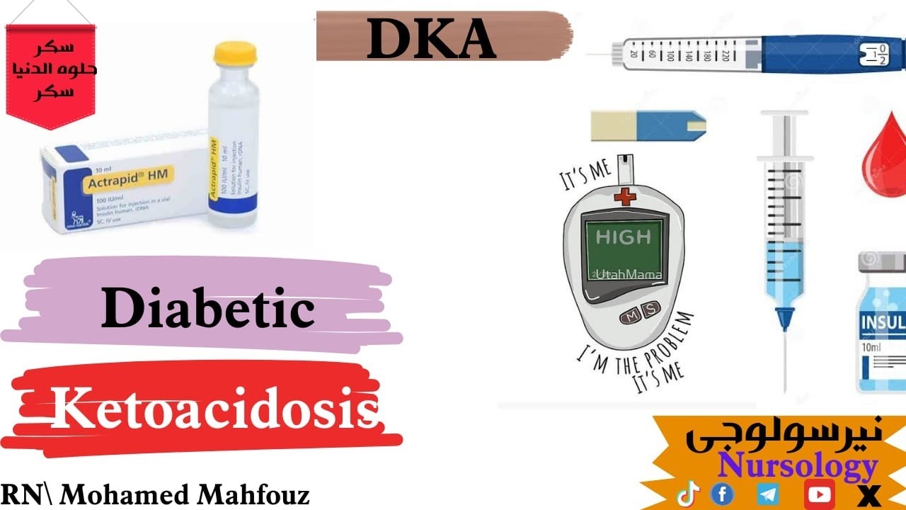 غيبوبة السكر المرتفع DKA || Diabetic Ketoacidosis