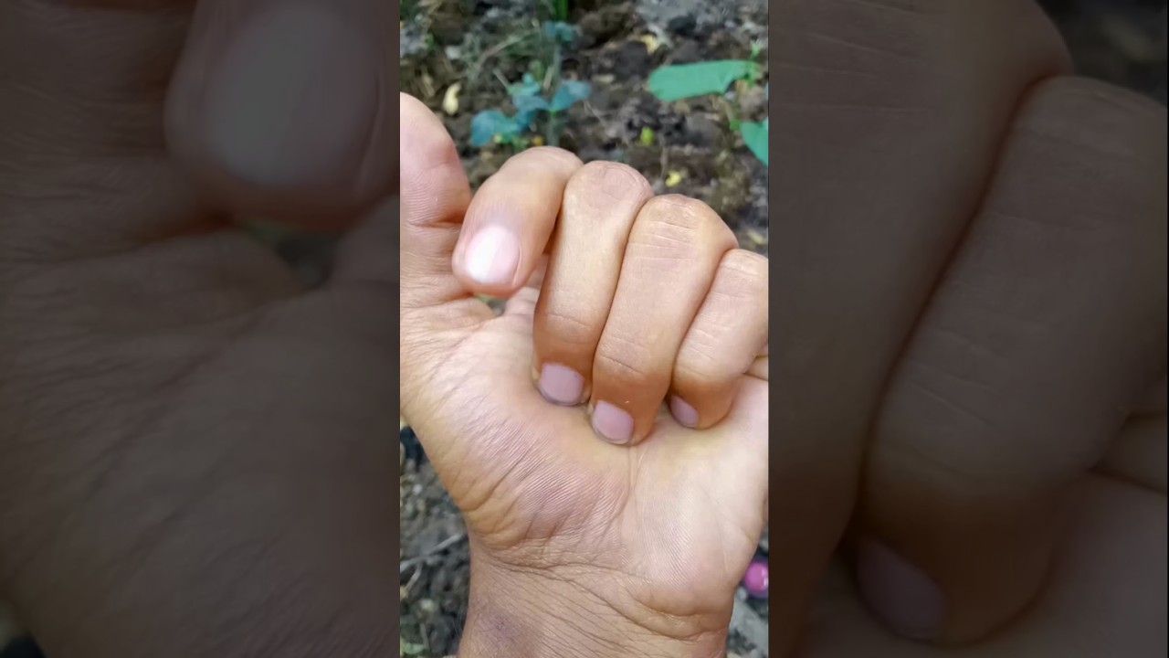 I found many Tick #jwildlifetv