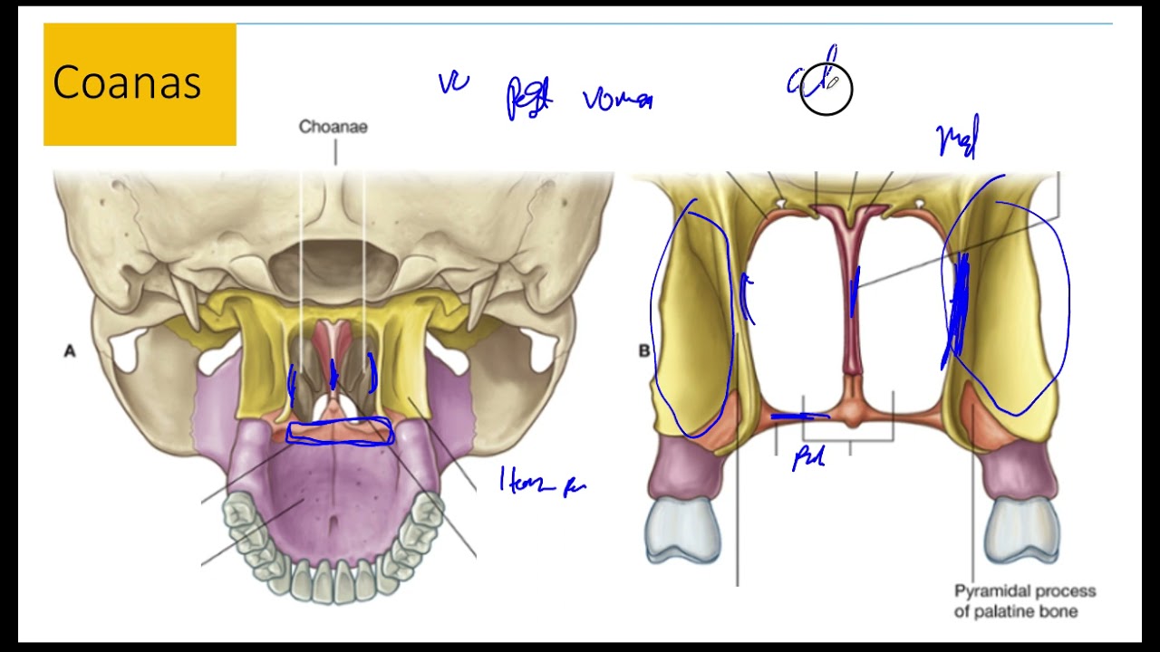 Fronteras de las Coanas. Anatomia Cavidad Nasal