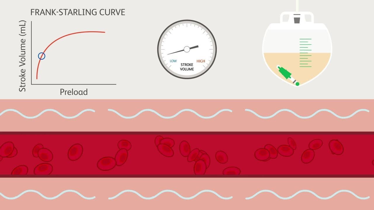 Critical Insights: Individualized De-resuscitation - The Physiology of Fluid Removal