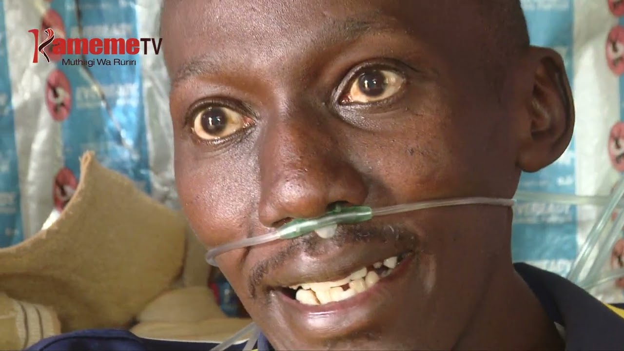 Mitangiko ya arwaru a murimu wa TB