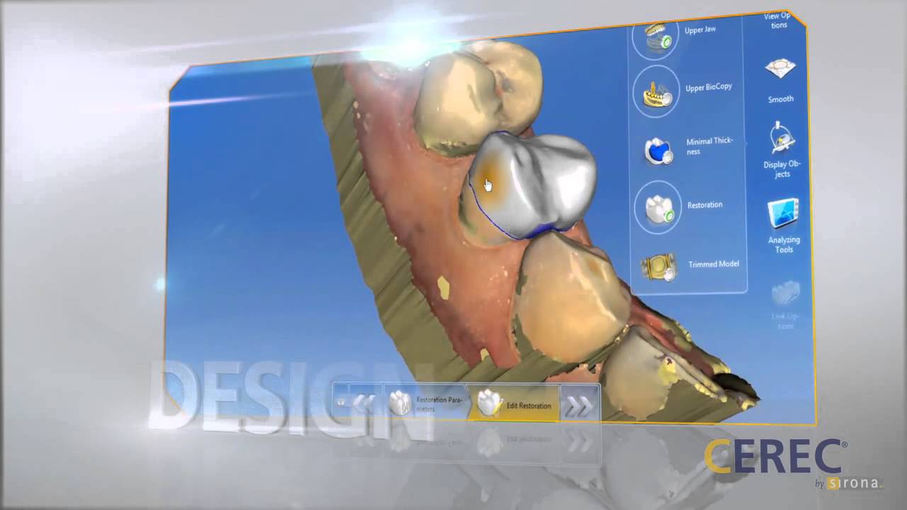 Cerec Omnicam Introduction
