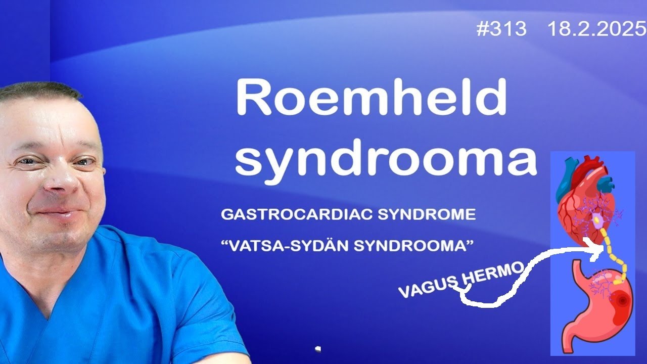 314 Roemheld syndrooma liian tuntematon