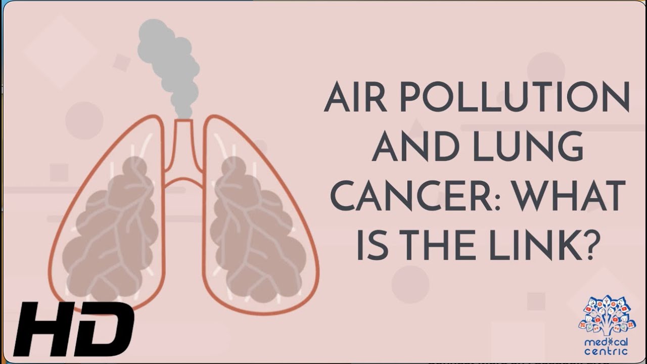 From Haze to Harm: The Impact of Air Pollution on Lung Cancer