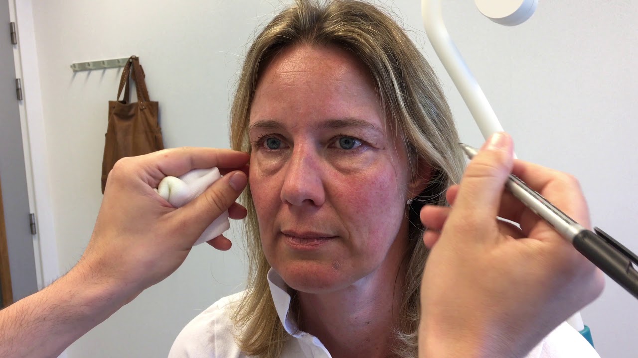 Kliniek Bloemingdael ooglidcorrectie promo