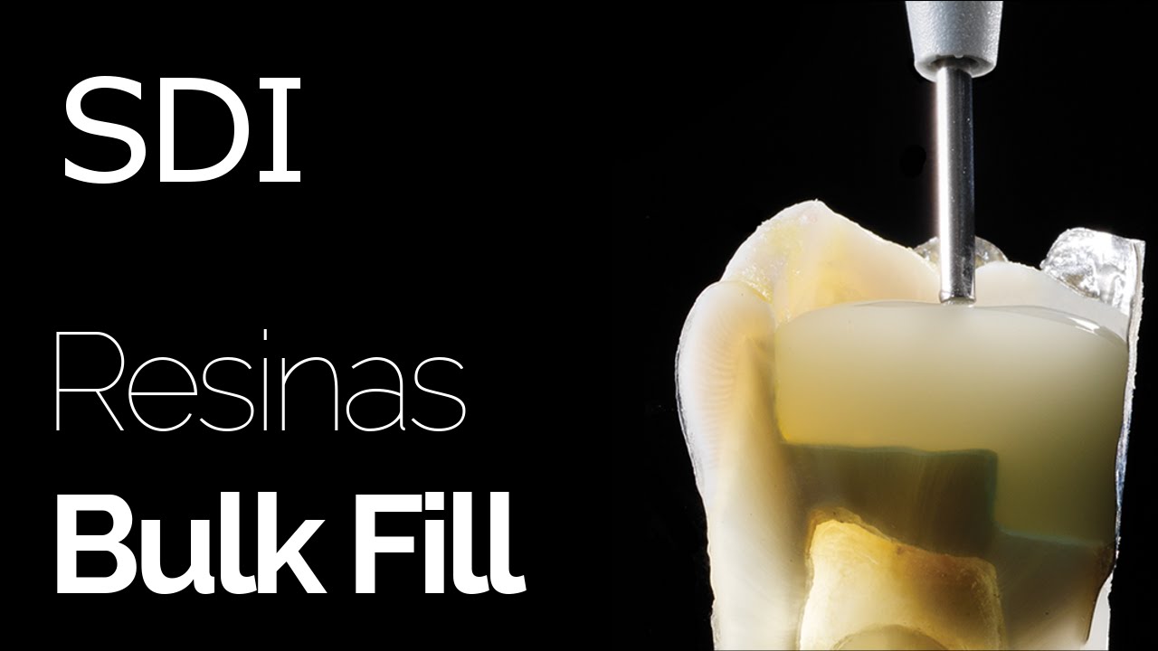 SDI - Resinas Bulk Fill