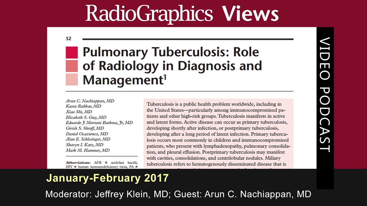 Pulmonary Tuberculosis: Role of Radiology in Diagnosis and Management